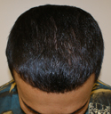 hair doctor