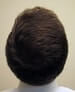 restore hair