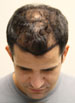 plan to restore hair
