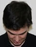 Hair Restoration