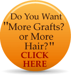 $3 grafts