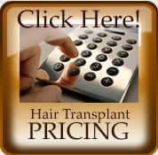 Hair Transplant Cost