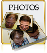 before after pictures