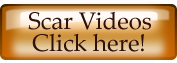 see hair transplant scar videos