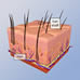 Male Pattern Baldness