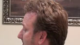 hair  surgeon