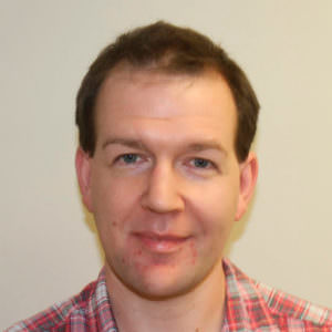 Dr. Bolton - Great Hair Transplants Updates European Patient Flies In To Have Hair Transplant Before And Afters Crown Hairline Healing/Growth Process MaxHarvest Plus™ Procedures