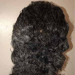 Back Again For More Hair Density Before And Afters Hairline Healing/Growth Process Testimonials 