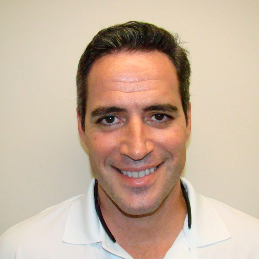 Hairline And Crown Thickening Hair Transplant Dr. Brett Bolton's