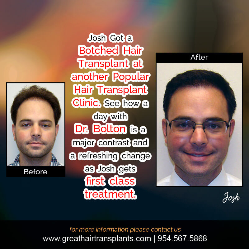 Josh - Hair Transplant Update! Before And Afters Difficult Cases Hairline Short Videos 