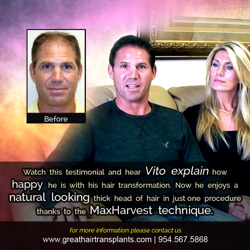 Vito - Hair Transplant Update! Before And Afters Difficult Cases Hairline Short Videos 