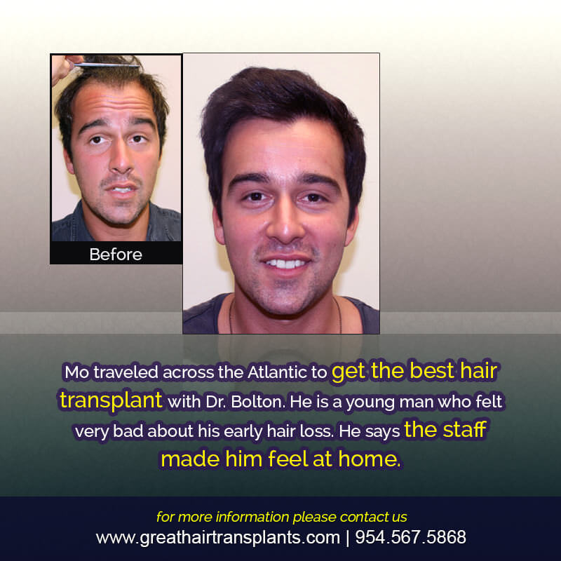 Mo's Hair  Transplant Story Before And Afters Difficult Cases Hairline Short Videos 