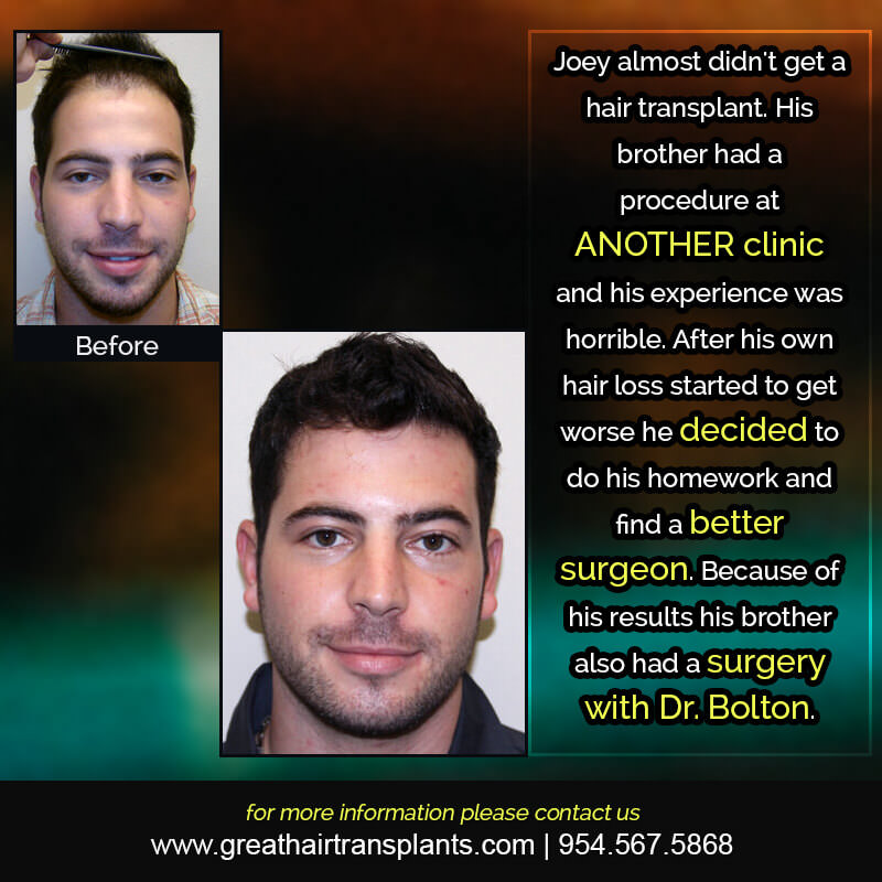 Joey's Hair  Transplant Story Before And Afters Difficult Cases Hairline Short Videos 