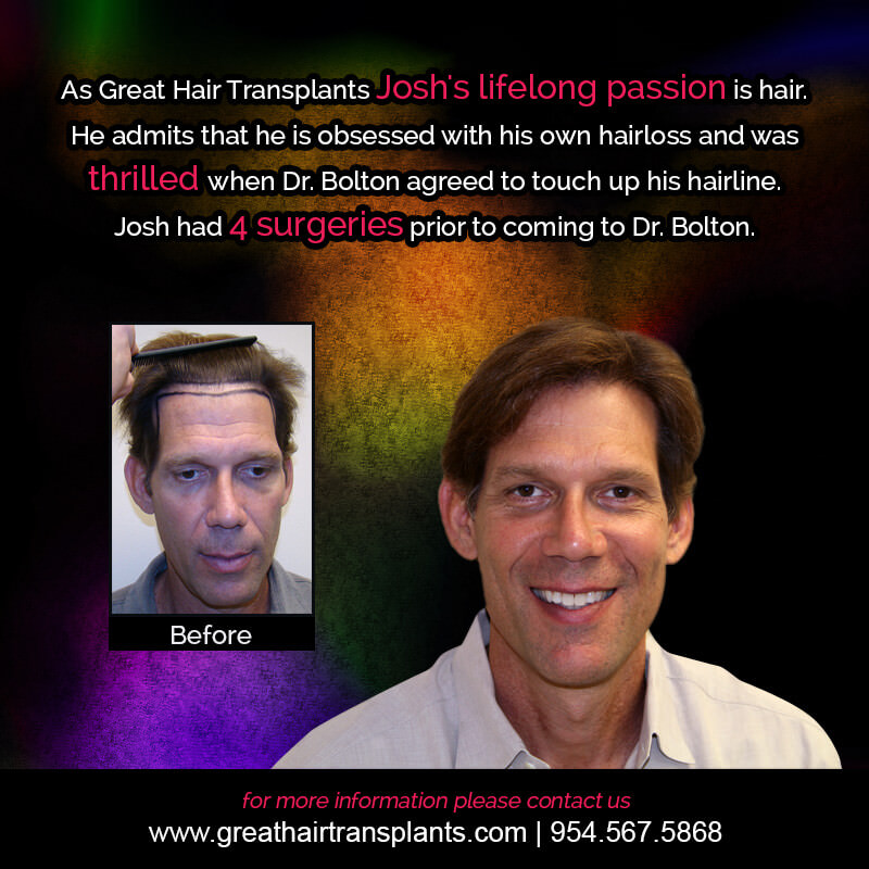 Josh's Hair  Transplant Story Before And Afters Difficult Cases Hairline Short Videos 