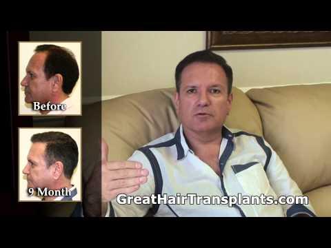 Hair Transplant Video