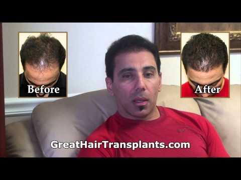 Hair Transplant Videos