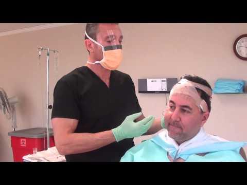 Hair Transplant Video