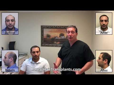 Hair Transplant Video