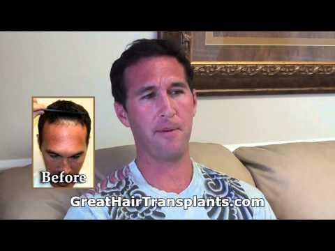 Hair Transplant Videos