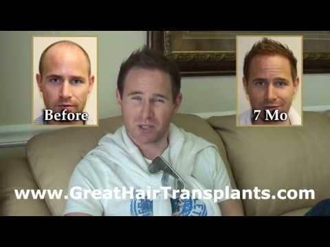 Hair Transplant Videos