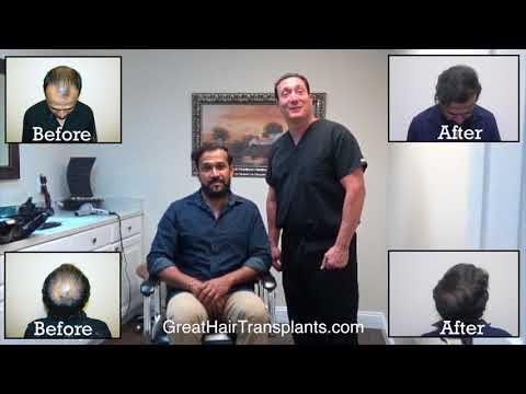 Hair Transplant Videos