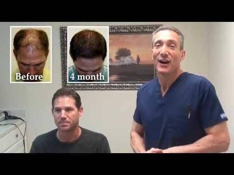 Hair Transplant Videos