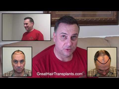 Hair Transplant Videos