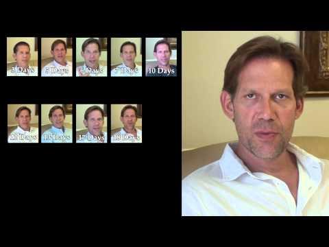 Hair Transplant Video