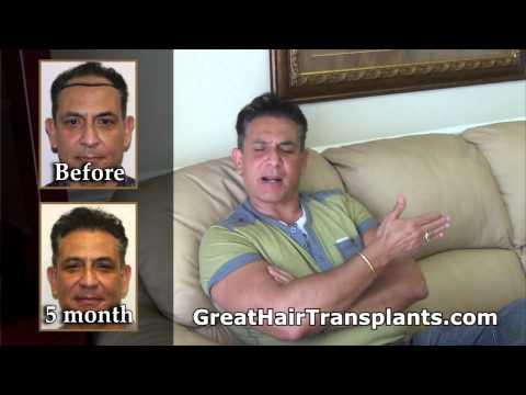 Hair Transplant Videos