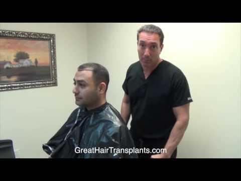 Hair Transplant Video