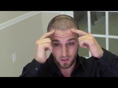 Hair Transplant Videos