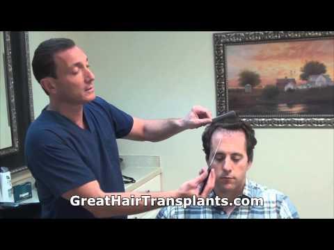 Hair Transplant Videos