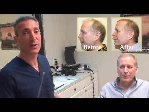 Hair Transplant Videos