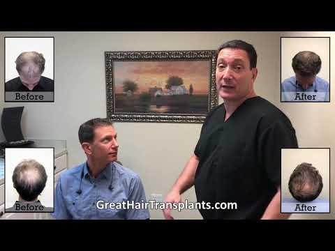 Hair Transplant Video