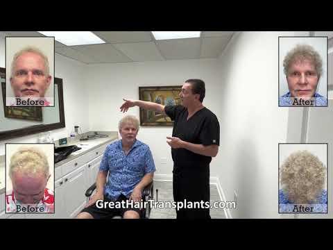 Hair Transplant Video