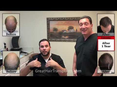 Hair Transplant Videos