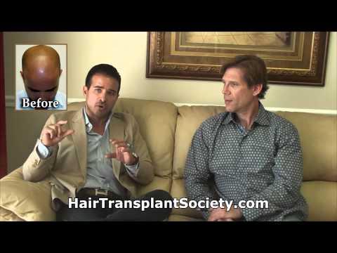 Hair Transplant Videos