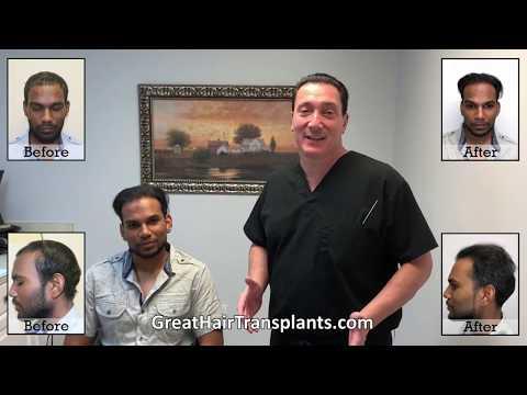 Hair Transplant Video