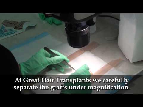 Hair Transplant Video