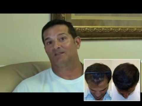 Hair Transplant Videos