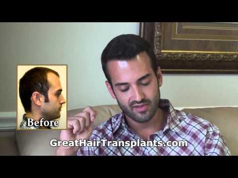 Hair Transplant Videos