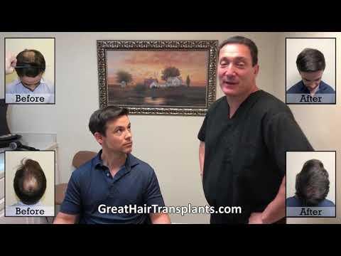 Hair Transplant Video