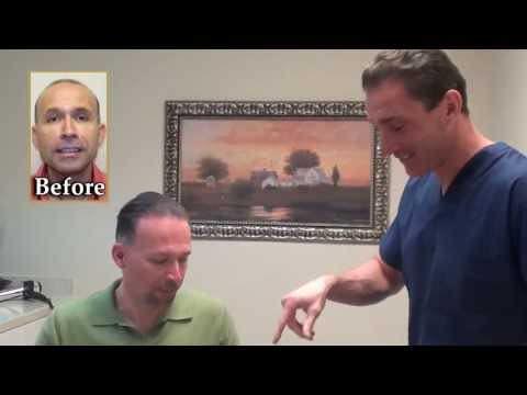 Hair Transplant Videos