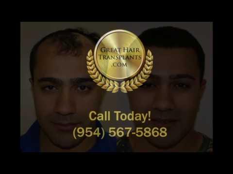 Hair Transplant Videos