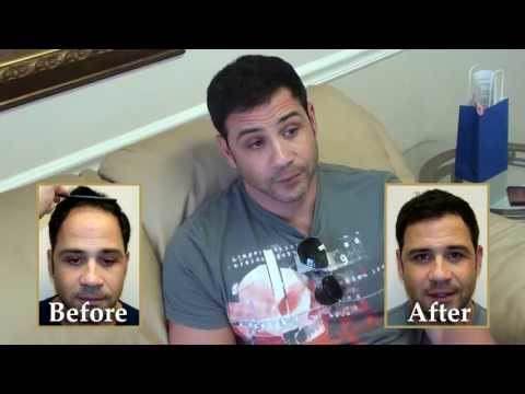 Hair Transplant Videos