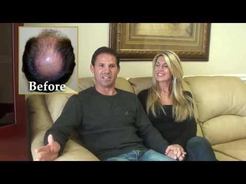 Hair Transplant Videos