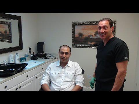 Hair Transplant Video