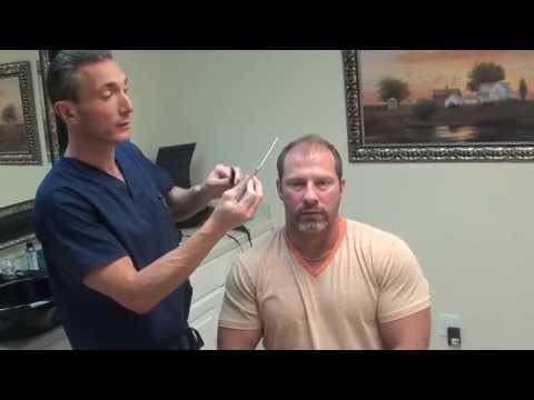 Hair Transplant Videos