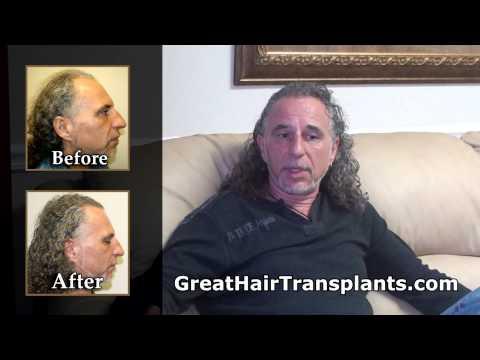 Hair Transplant Videos