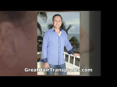 Hair Transplant Videos